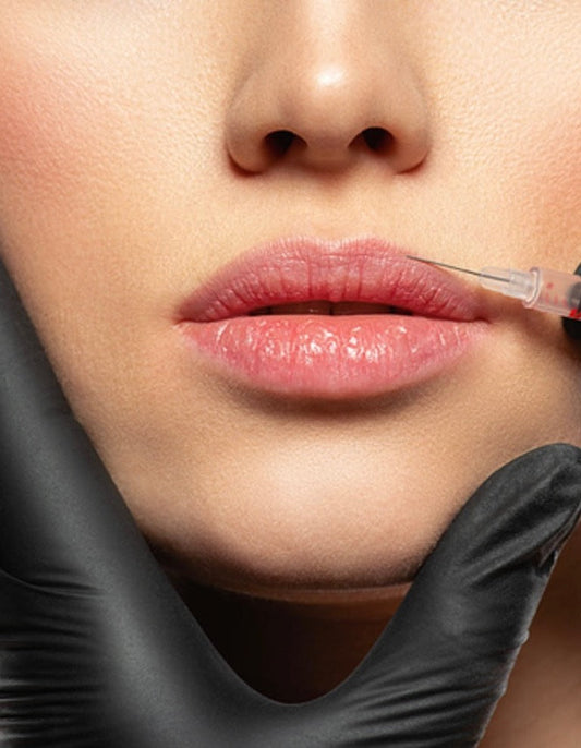 Natural lip enhancement  and Russian lip newcastle | lip filler Gosforth | lip filler Ponteland 