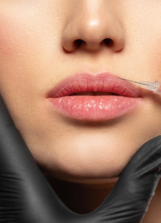 Natural lip filler Gosforth  | Lip enhancement newcastle